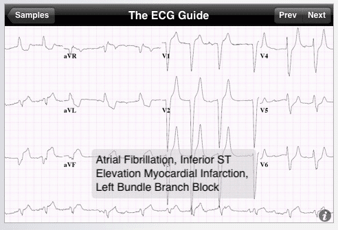 ECG Guide iPhone Apps